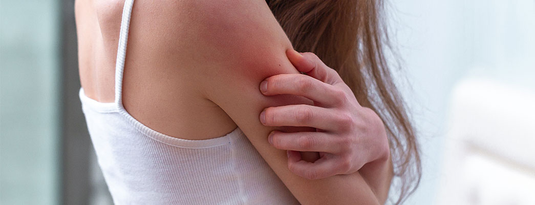 Atopische Dermatitis