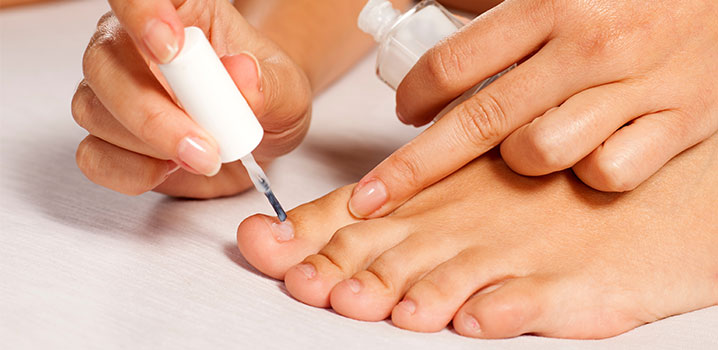 Nagelpilz: Mit Geduld zum Ziel